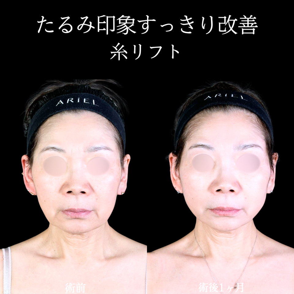 No.11343の症例写真