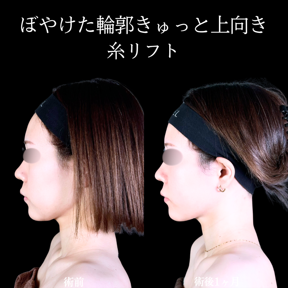 No.11398の症例写真
