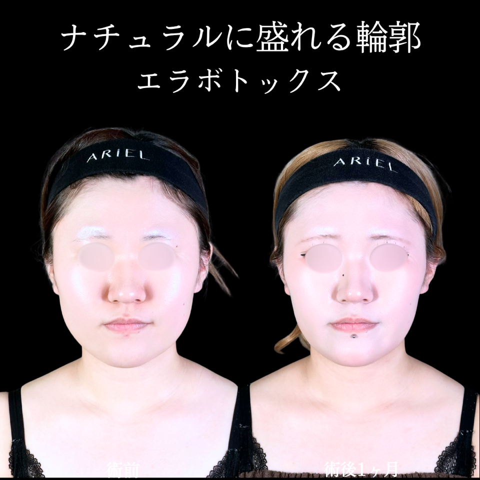 No.11324の症例写真