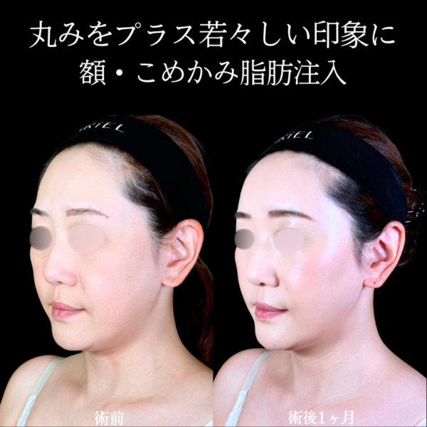 No.11361の症例写真