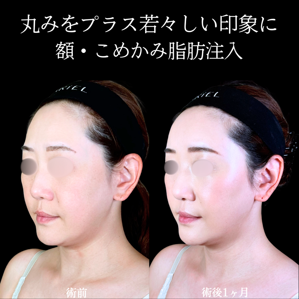 No.11361の症例写真