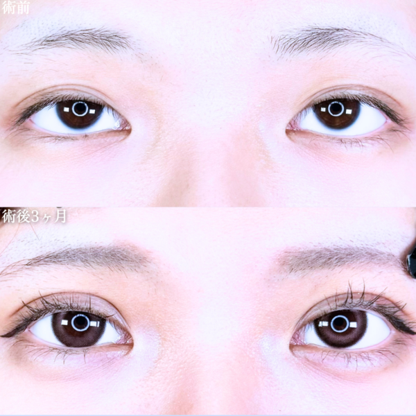 No.11601の症例写真 No.11601の症例写真