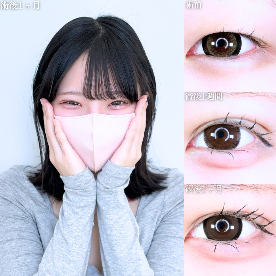 No.11446の症例写真