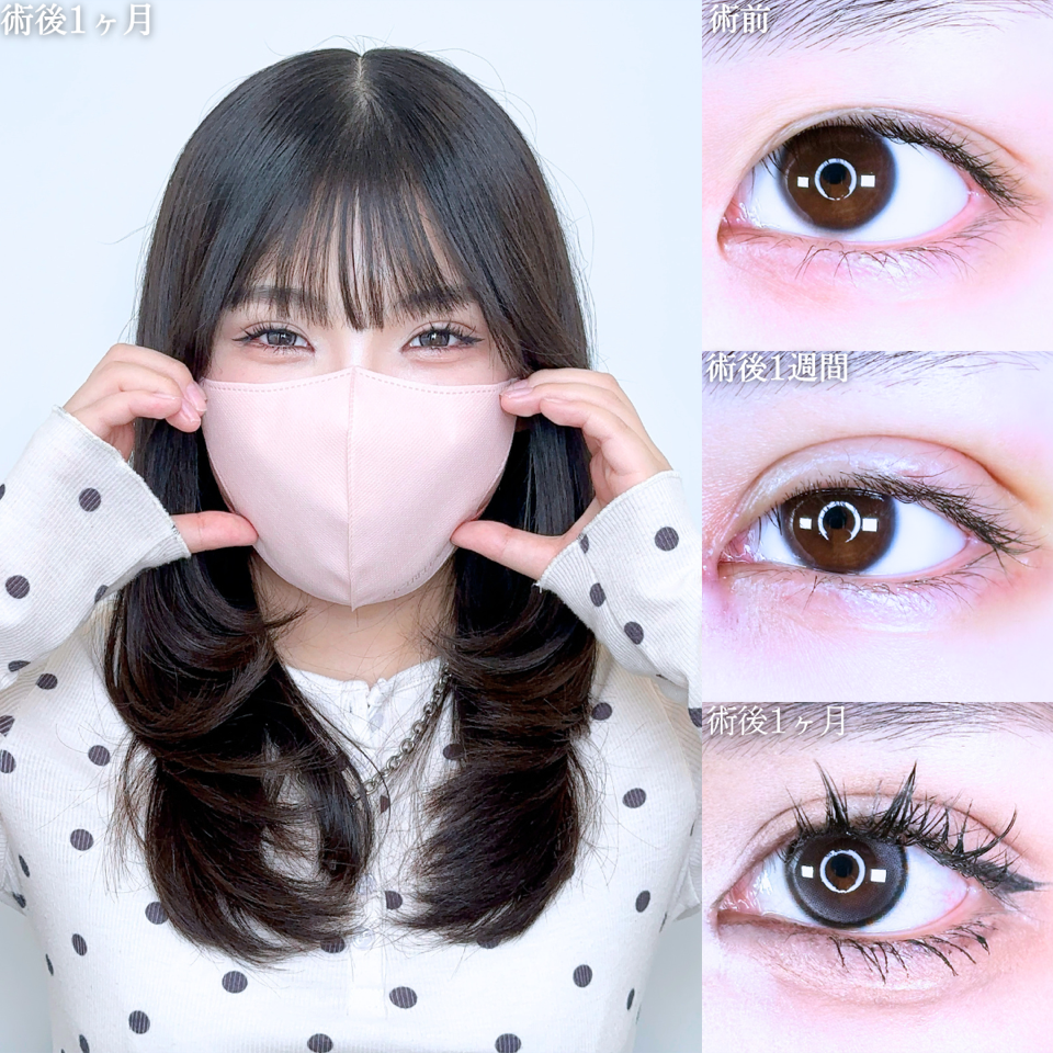 No.11424の症例写真