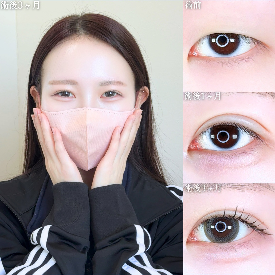 No.11464の症例写真