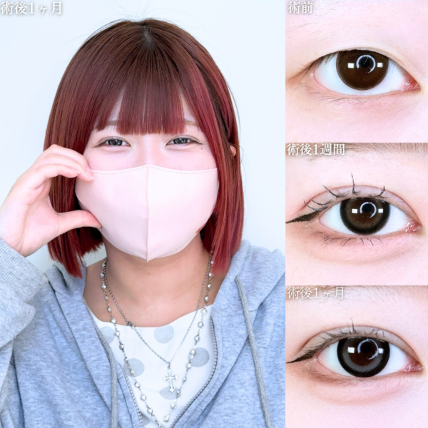No.11482の症例写真 No.11482の症例写真
