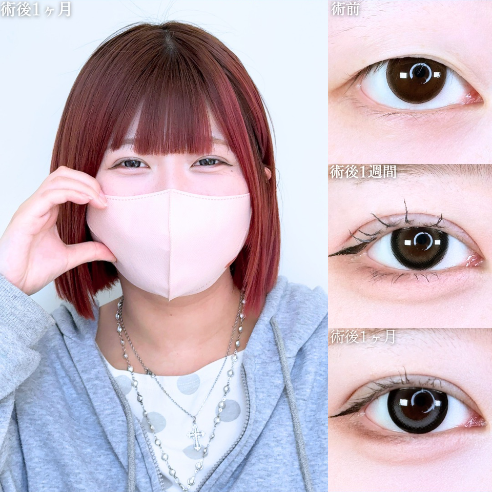 No.11482の症例写真