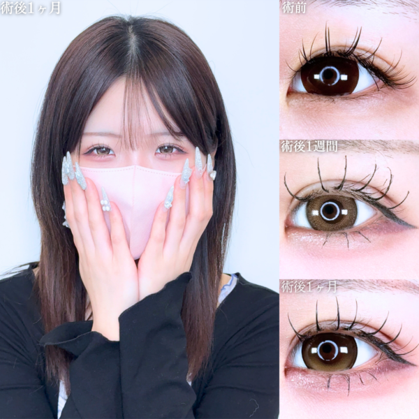 No.11574の症例写真 No.11574の症例写真