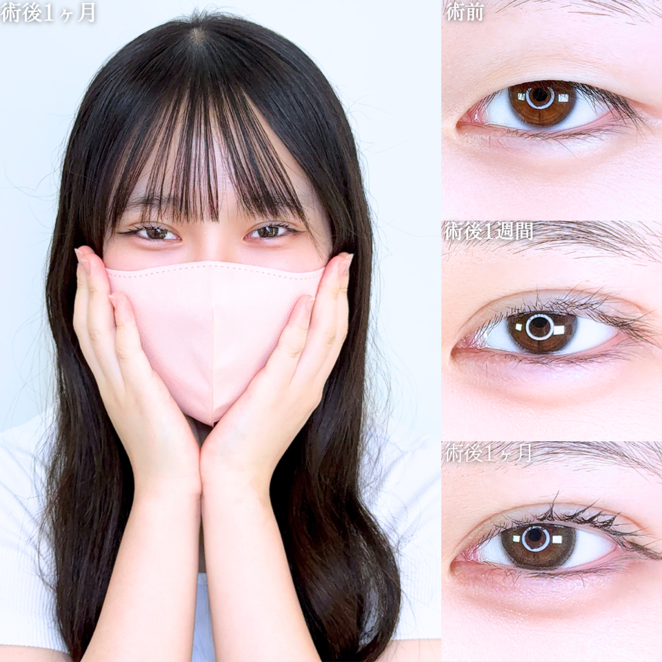 No.11595の症例写真
