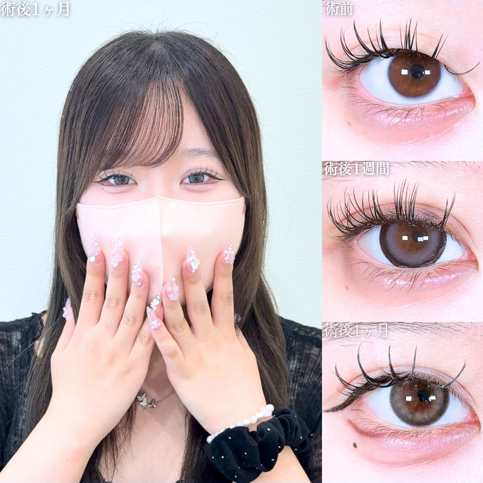 No.11410の症例写真