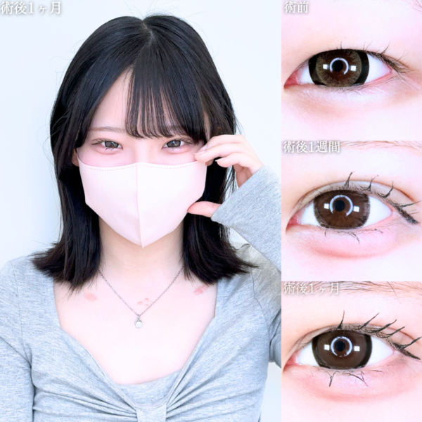 No.11330の症例写真