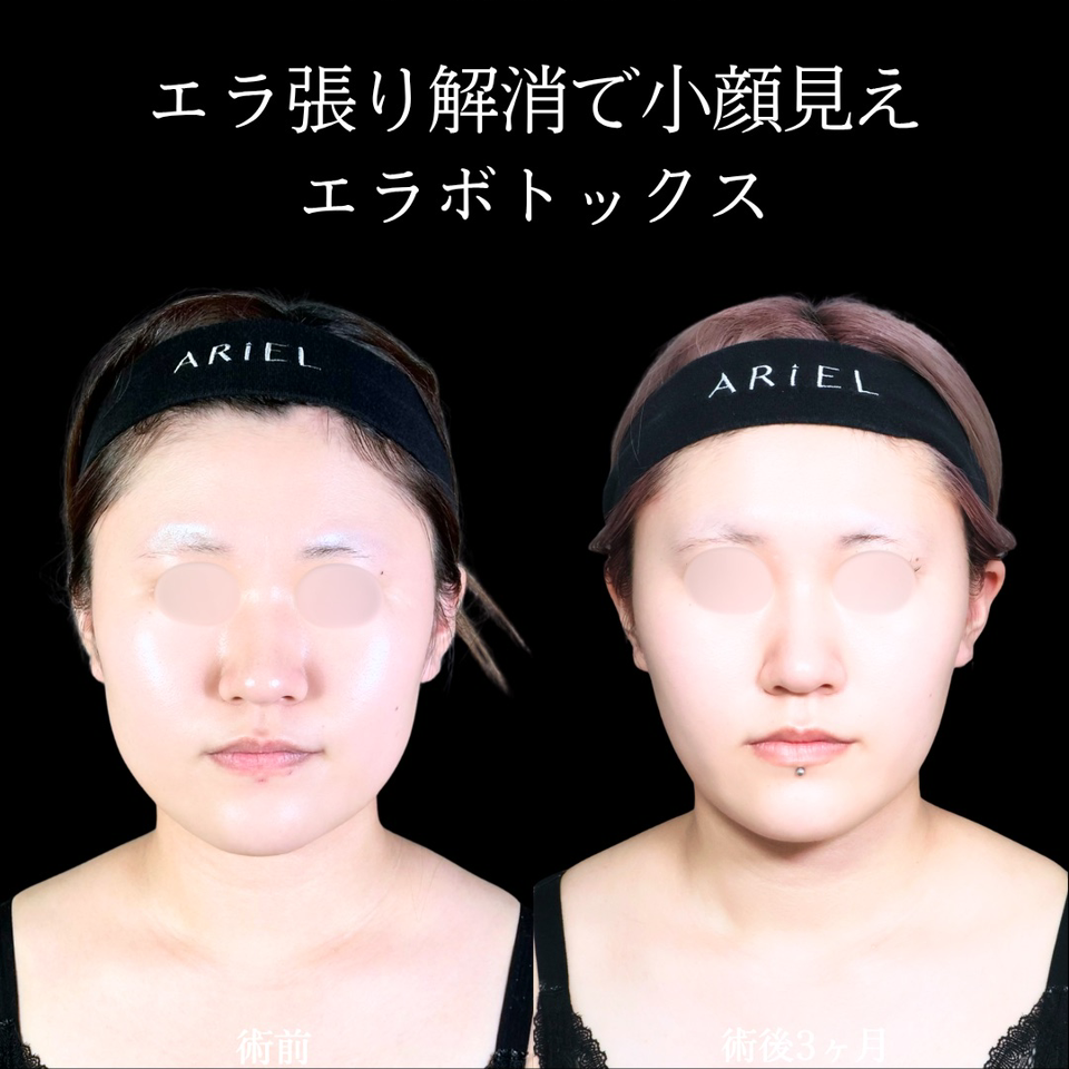 No.11626の症例写真