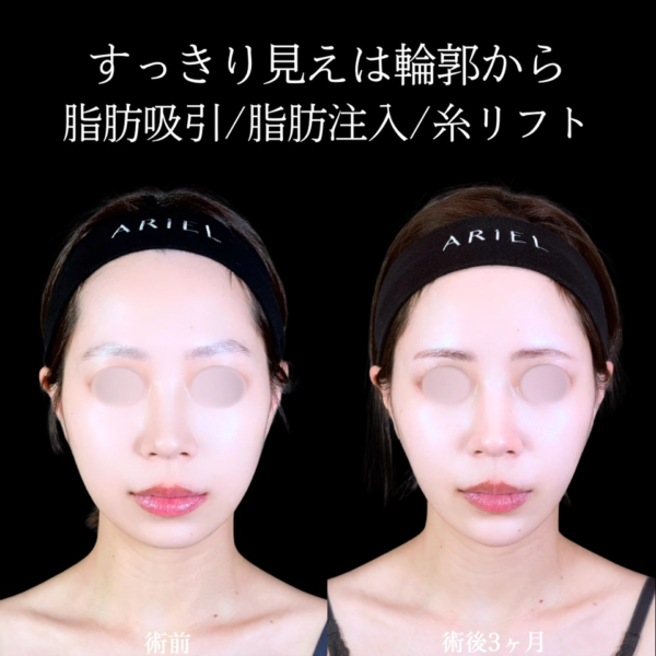 No.11614の症例写真