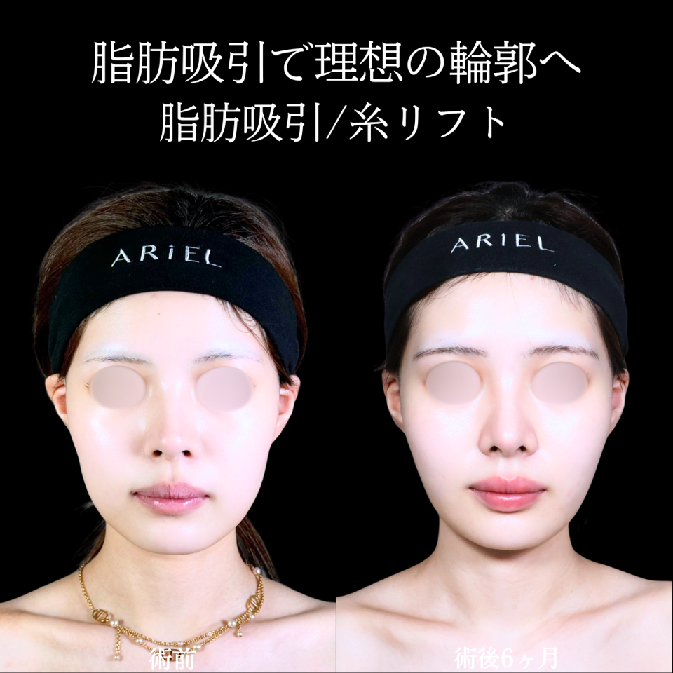 No.11660の症例写真