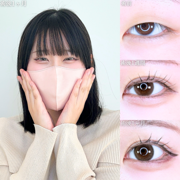 No.11669の症例写真