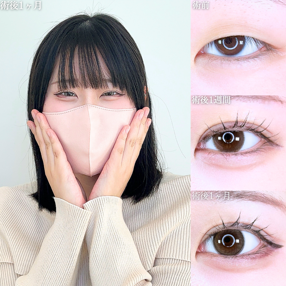 No.11669の症例写真