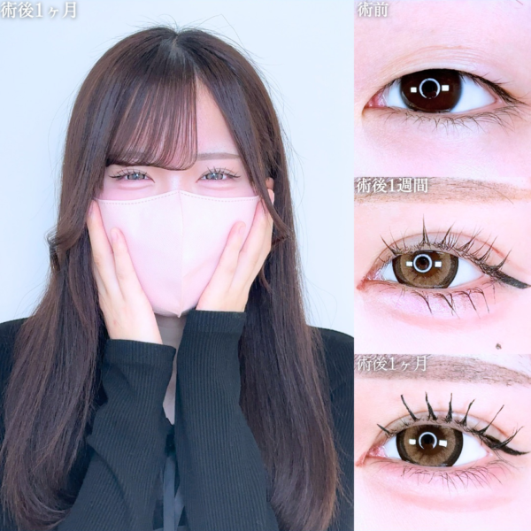 No.11608の症例写真 No.11608の症例写真